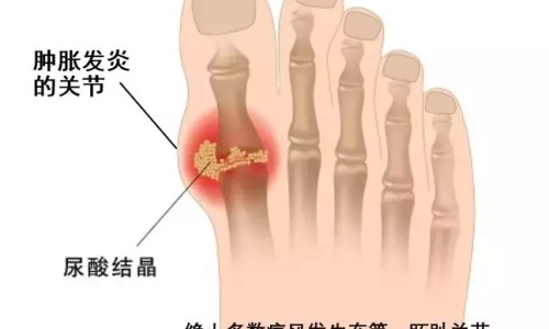 【鼻炎灵片一旦吃了就不能停吗】鼻炎灵喷雾 - 鼻炎灵片的价格网